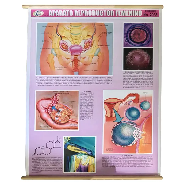 [LA1400] LAMINA PLASTIFICADA APARATO REPRODUCTOR FEMENINO CON BASTON Marca LABESSA