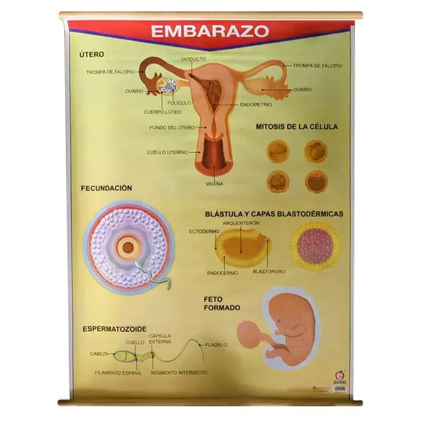 [LA2080] LAMINA PLASTIFICADA EL EMBARAZO CON BASTON Marca LABESSA