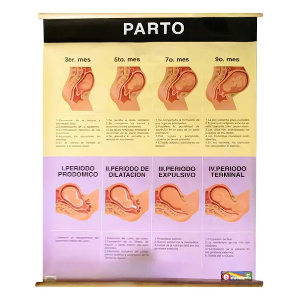 [LA2600] LAMINA PLASTIFICADA PARTO CON BASTON Marca LABESSA