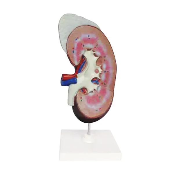 Modelo de riñón Marca LEEX