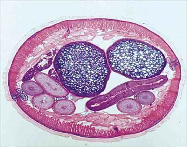 PREPARACION ASCARIS (LOMBRIZ INTESTINAL) C.S. Marca LEEX