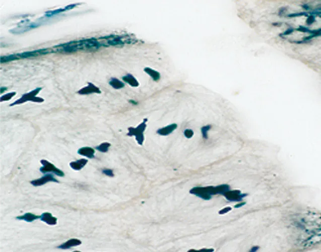 PREPARACION DE TESTICULO DE SALTAMONTES SEC. Marca LEEX