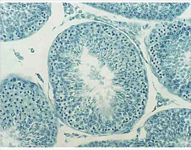 PREPARACION DE TESTICULO Marca LEEX
