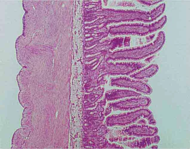 PREPARACION INTESTINO C.S. Marca LEEX