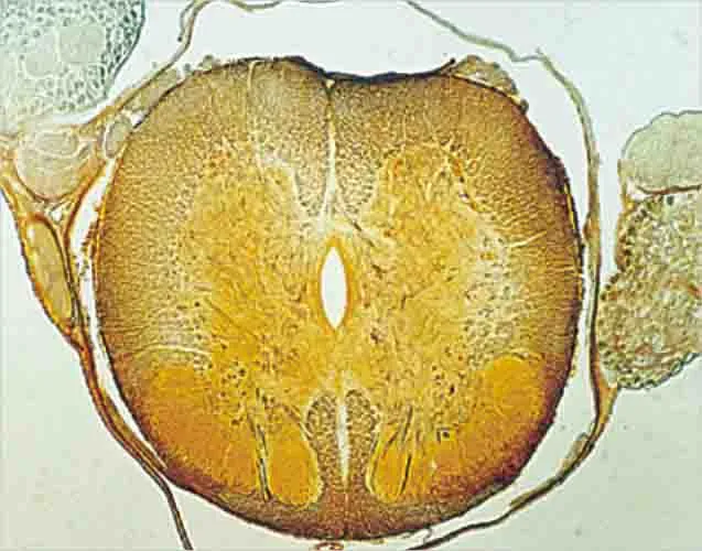 PREPARACION MEDULA ESPINAL CS Marca LEEX