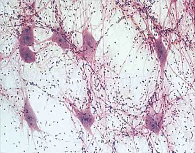 PREPARACION NEURONA WM Marca LEEX