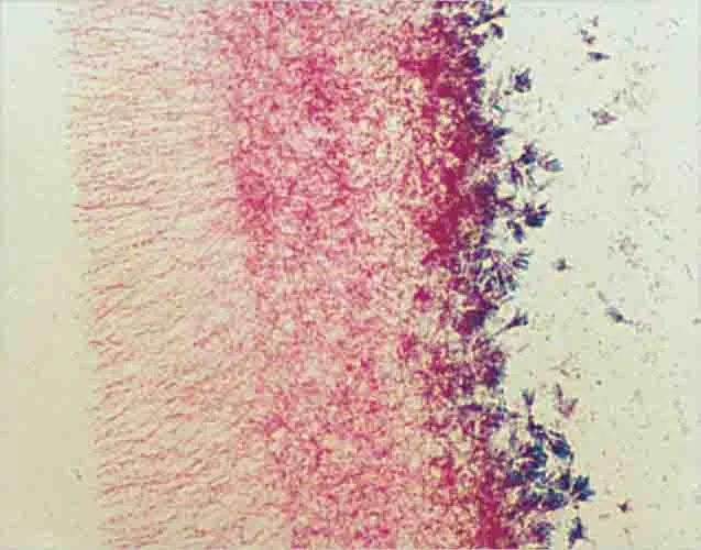 PREPARACION PENICILLIUM W.M. Marca LEEX