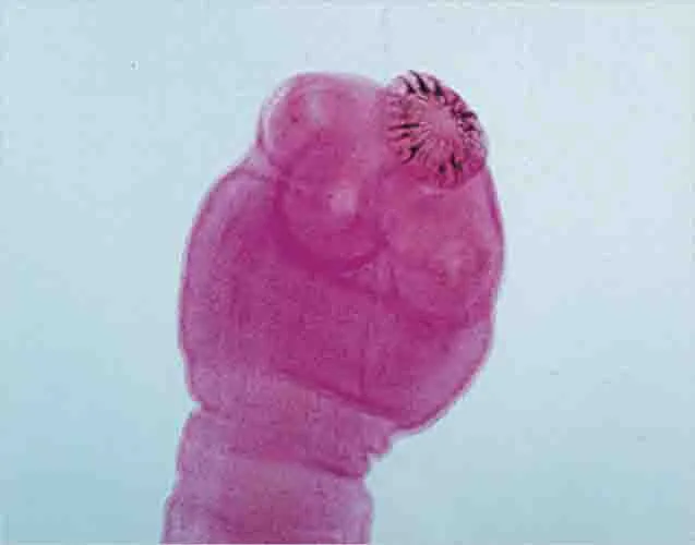 TAENIA SOLIUM SCOLEX WM Marca LEEX