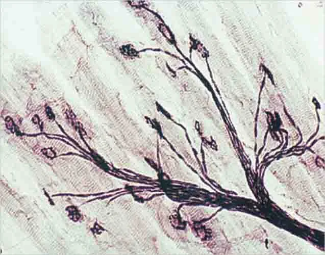 TERMINALES NERVIOSAS MOTORAS WM Marca LEEX